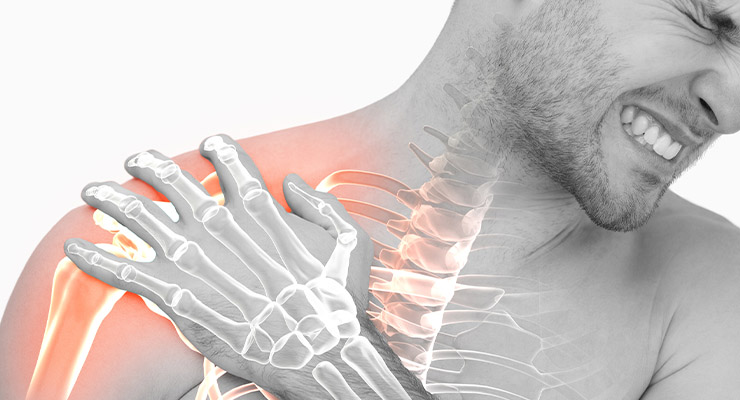 Симптомы разрыва и надрыва связок плечевого сустава