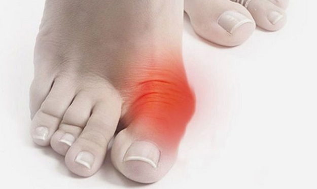 Болит косточка на большом пальце ноги: причины, симптомы, лечение