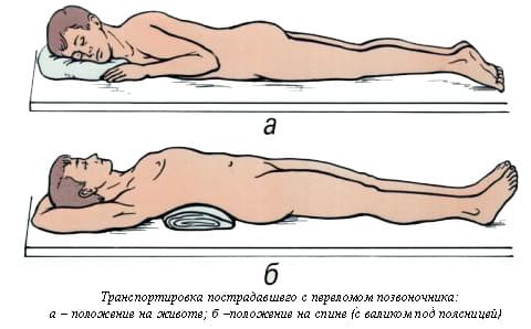 Перелом позвоночника. Первая помощь