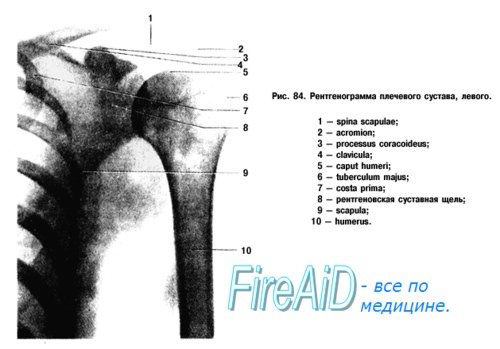 Рентгенограмма плечевого сустава