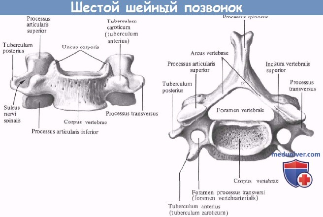 Анатомия шестого шейного позвонка