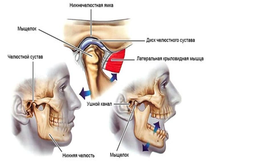 Не открывается рот болит. Верхнечелюстной сустав ВНЧС. ВНЧС анатомия движения. Височно верхнечелюстной сустав анатомия.