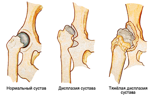 Рисунок иллюстрирует степени тяжести заболевания