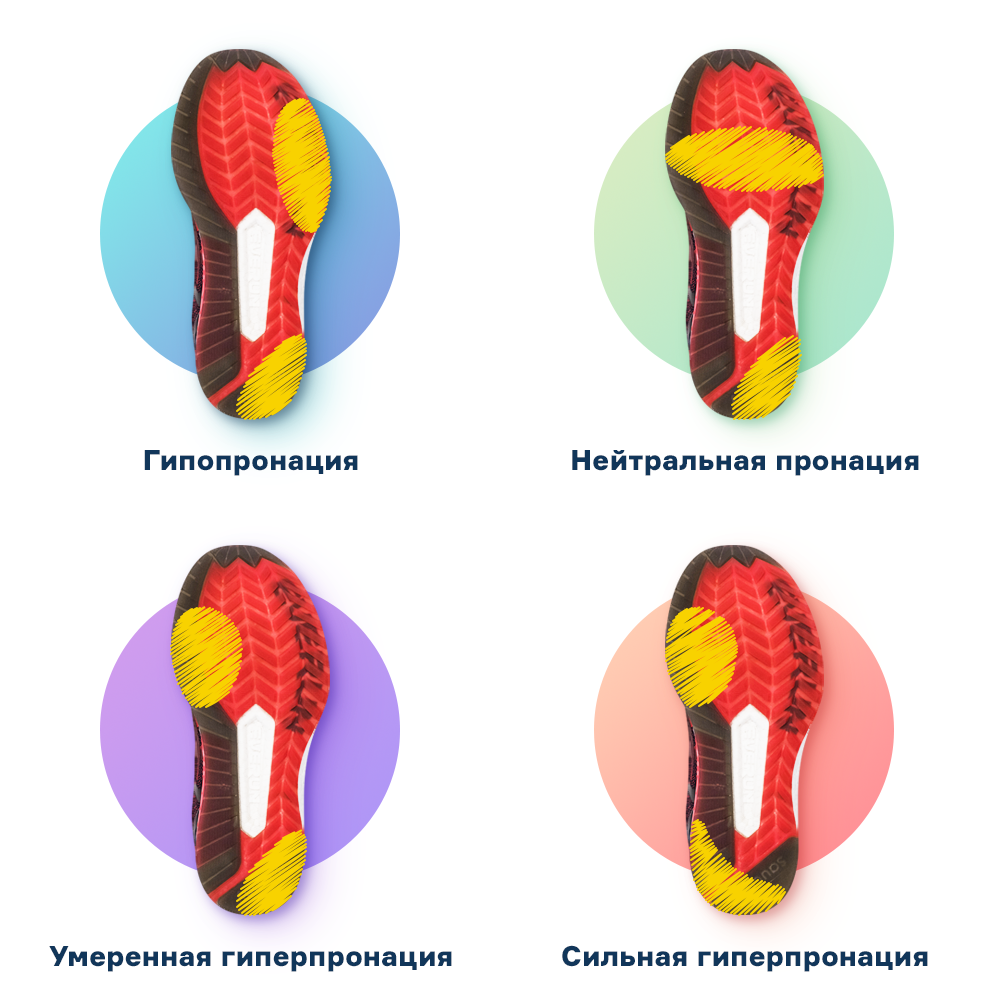 Все, что нужно знать бегуну о гиперпронации