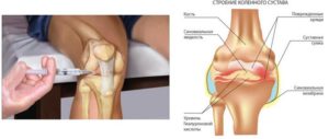 Лечение коленного сустава