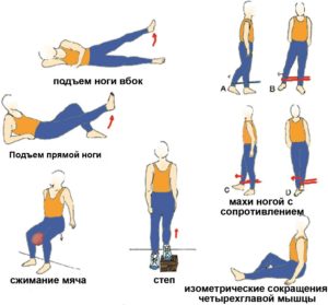 упражнения для укрепления коленных суставов