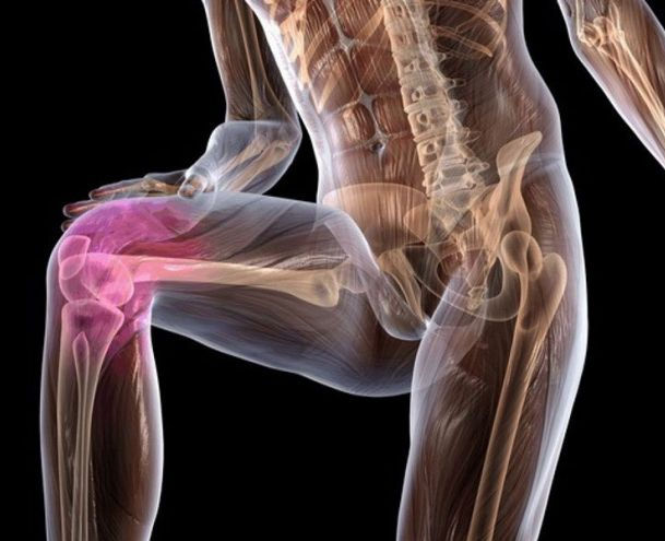 Как укрепить коленные суставы и мышцы в домашних условиях