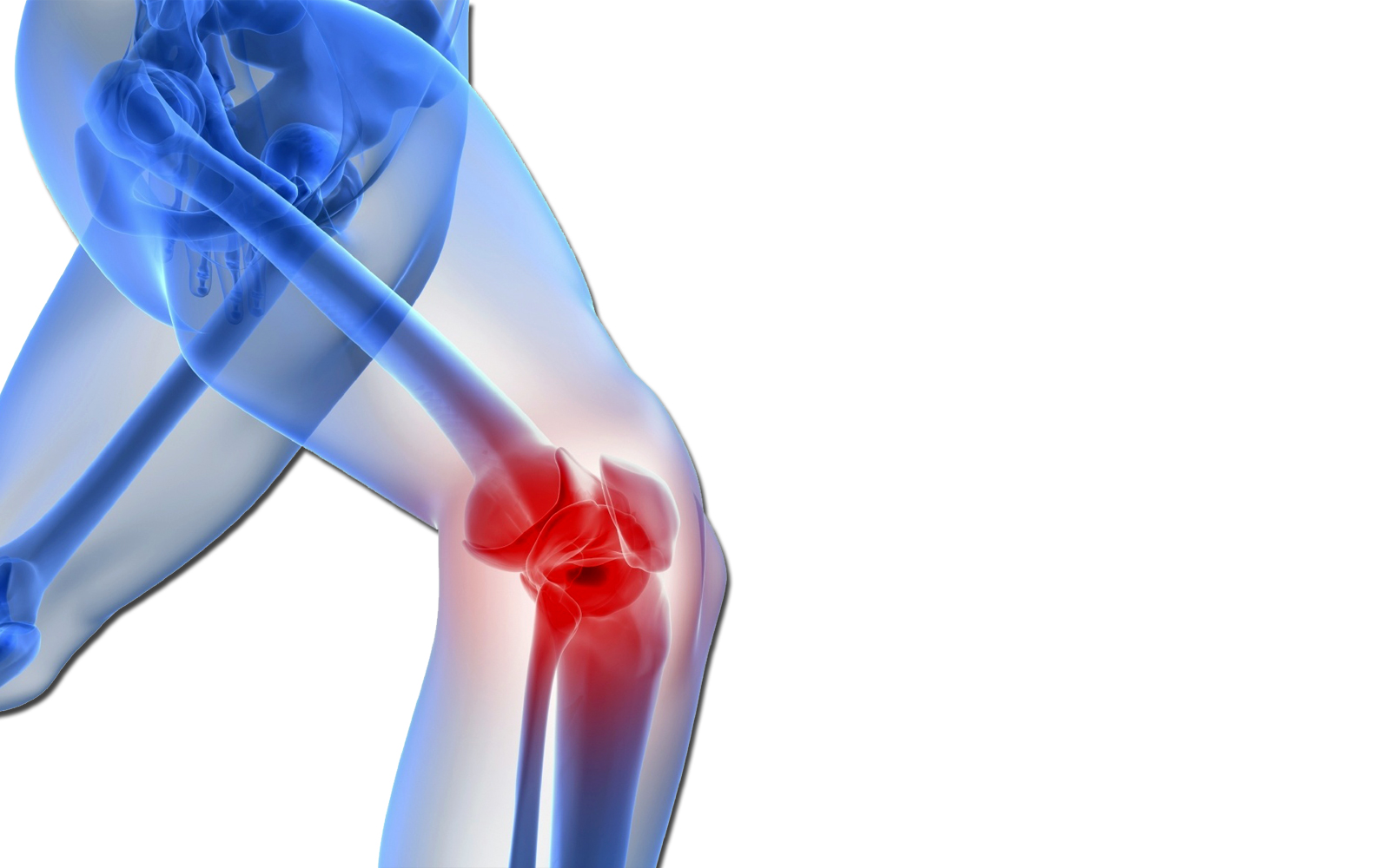 Артротомия коленного сустава обнажение и вскрытие колена