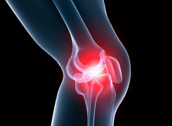 Периартрит коленного сустава - причины, симптомы, лечение