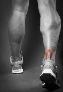 Травма сухожилия ноги