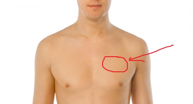 Нажать на сосок. Болит вверху в грудине. Болит с левой стороны над грудной клеткой. Боль с левой стороны грудной клетки. Болит левая часть грудины.