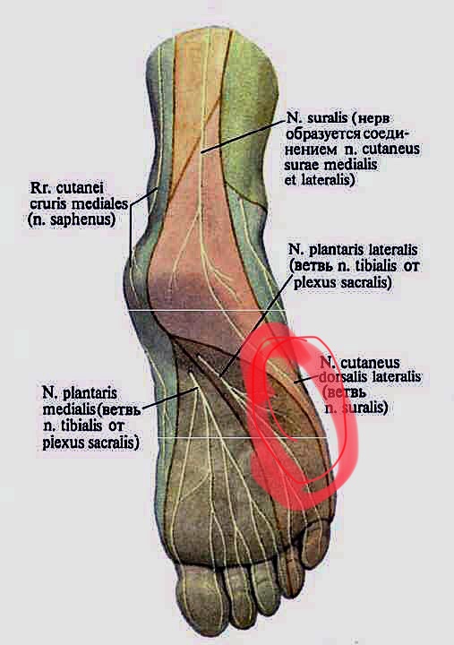 Причина боли подошвы стопы. Болит мышца в стопе снизу. Наружная часть стопы.