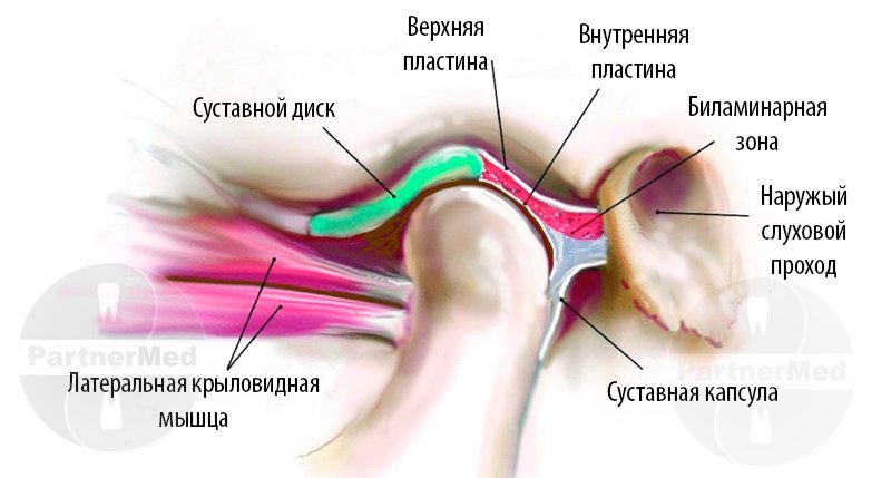 Внчс лечение в клинике, методы лечения нижнечелюстного сустава