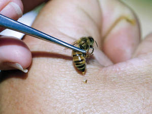 Метод лечения пчелами