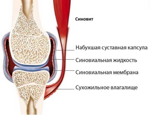 Заболевание