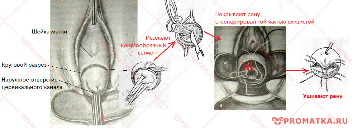 Операция Штурмдорфа