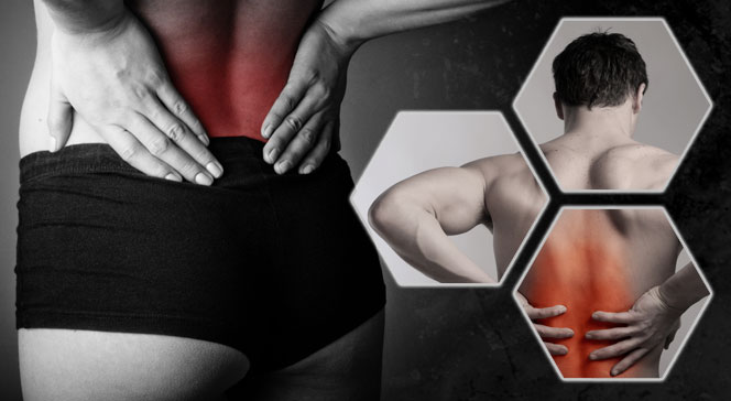 Растяжение мышц спины: лечение и симптомы