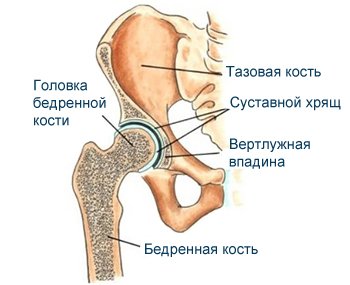 дисплазия тазобедренных суставов у грудничка