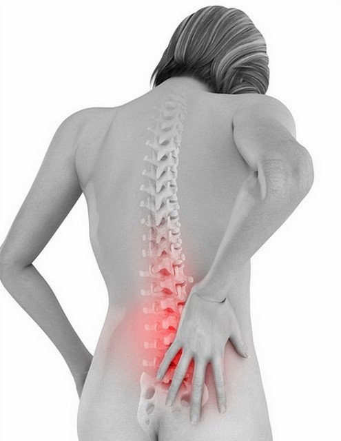 Радикулит приносит пациенту боли в верхней части спины