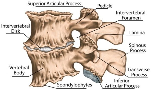 При остеохондрозе межпозвонковые отверстия сужаются, сдавливая сосуды и нервы, а по краю позвонков появляются разрастания костной ткани — остеофиты