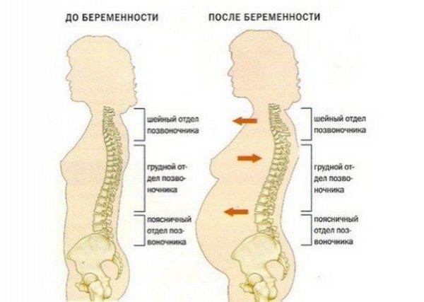 Схема строения позвоночника у женщин до беременности и во время
