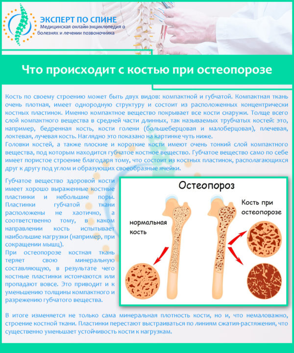 Что происходит с костью при остеопорозе