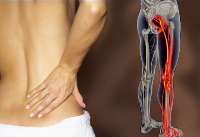 Боль в спине, сопровождающаяся такими же ощущениями в ногах, является явным симптомом экструзии
