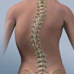 Основным противопоказанием к бегу является стойкий болевой синдром в спине
