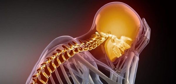 Главным фактором риска для развития ВБН является остеохондроз шеи