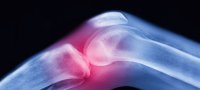 Особенности лечения болей в колене народными средствами