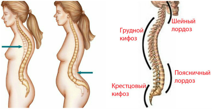 Проблемы с позвоночником и болезни спины: шейный отдел, грудной, поясничный.