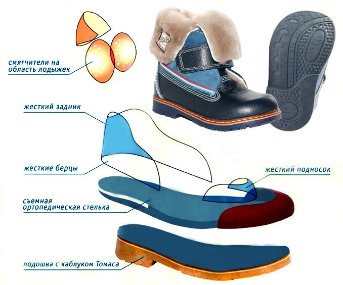 Как выбрать обувь при плоскостопии. Какую ни в ком случае нельзя одевать?