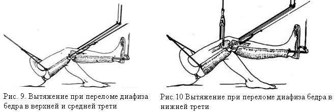 Бедро человека на картинке