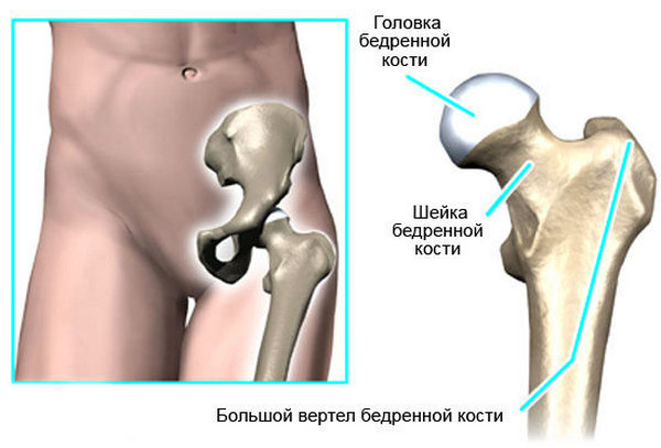 Шейка правого бедра. Малый вертел бедренной кости. Бедренная кость большой и малый вертел. Анатомия тазобедренного сустава вертел. Трохантерит тазобедренного сустава . Сухожилия.