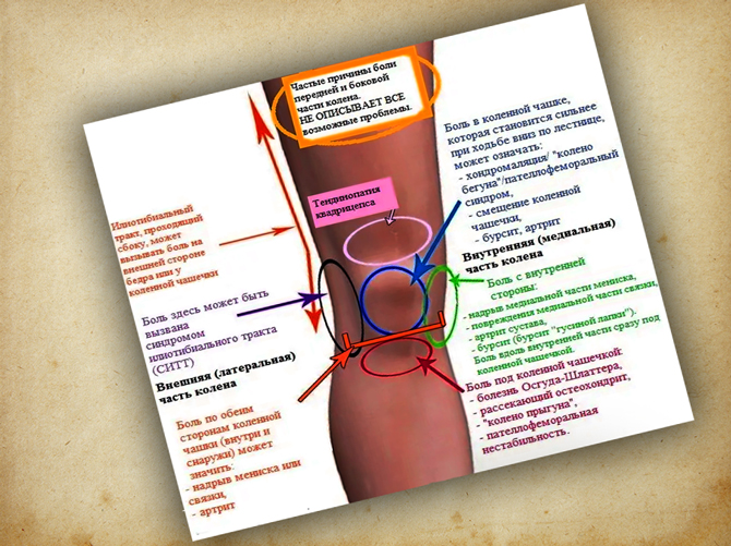 Классификация болезней по боли в колене