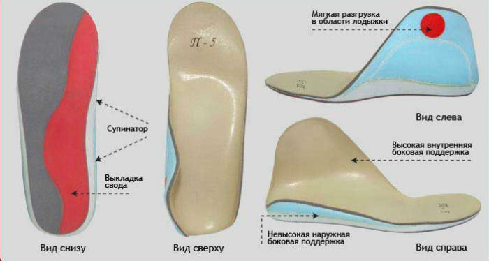 От пяточной шпоры уколы