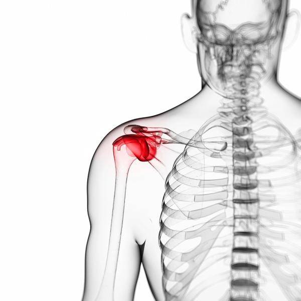 причины боли в плече почему болит плечо 