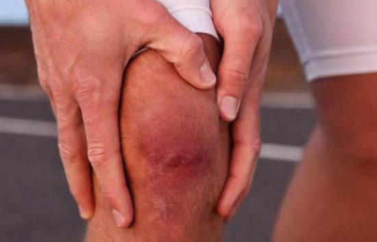 Воспаленный коленный сустав