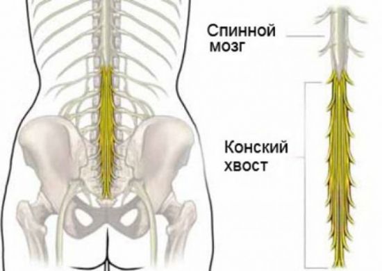 Конский хвост позвоночника