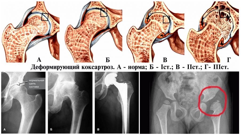 Исследование анализов 