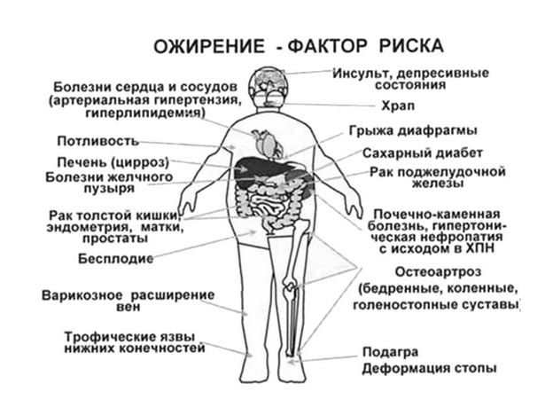 Факторы риска при ожирении