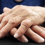 Артрит кисти руки: симптомы, диагностика и лечение