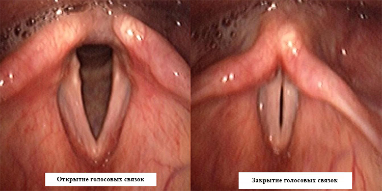 Открытие и закрытие голосовых связок