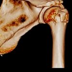 Перелом большого бугорка плечевой кости: причины, виды и методы лечения