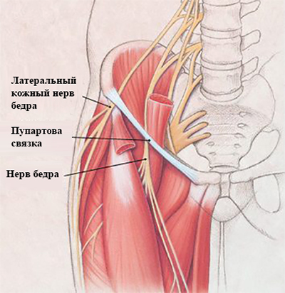 Как выглядит пупартова связка