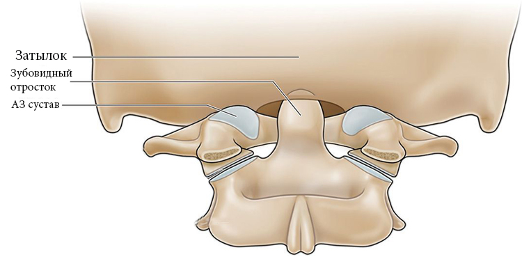 Вид атланто-затылочного сустава