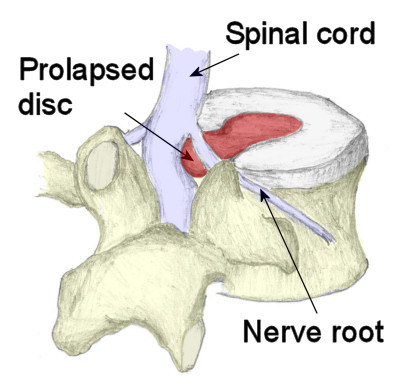Structure of the spine