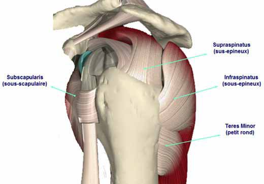 Повреждение сухожилия подлопаточной мышцы