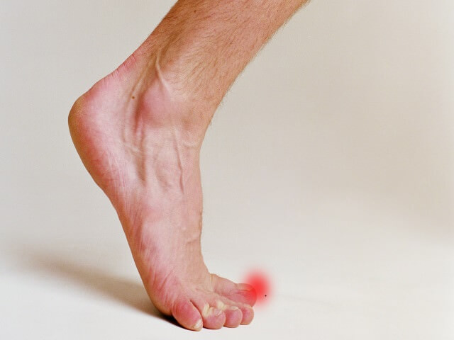 Травма ноги: симптомы