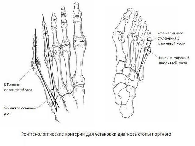 Кости пальцев